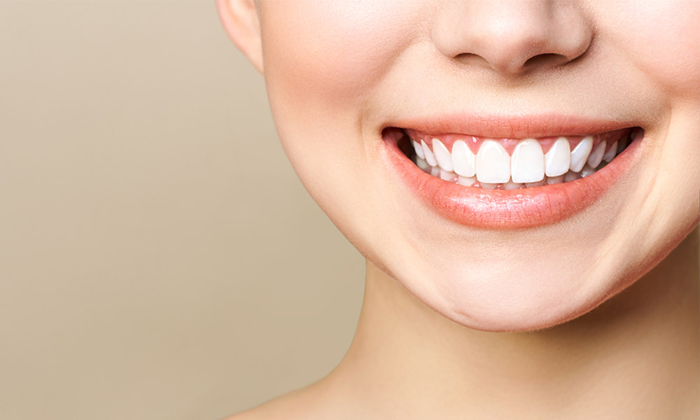 What to Expect During a Professional Teeth Whitening Session