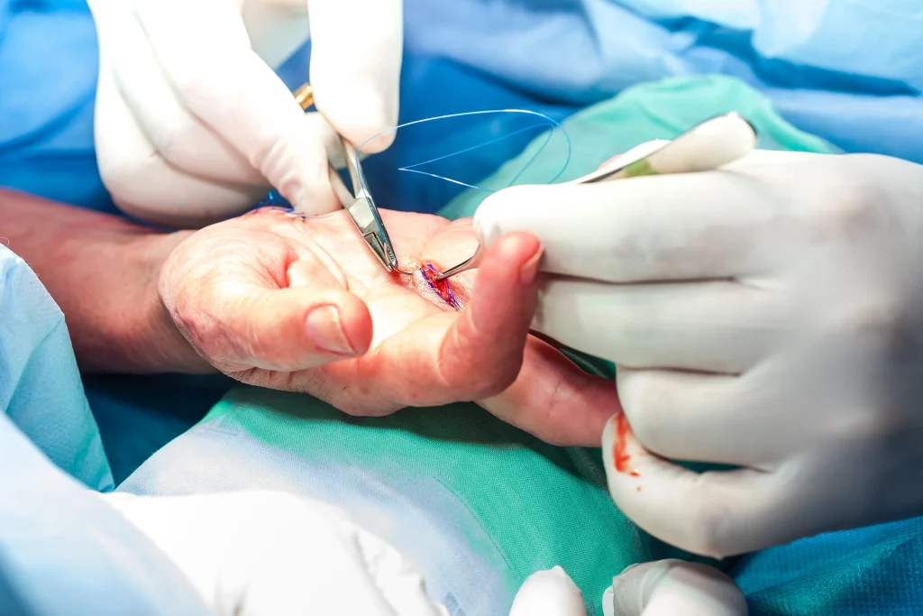 Understanding Mohs Surgery: The Ultimate Guide to Skin Cancer Treatment