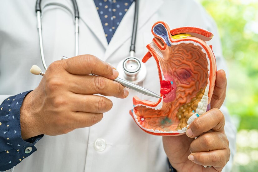 Stomach Cancer Symptoms: How to Identify the Warning Signs Early