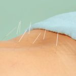 A Beginner’s Guide to Acupuncture: Tools, Techniques and Safety Tips